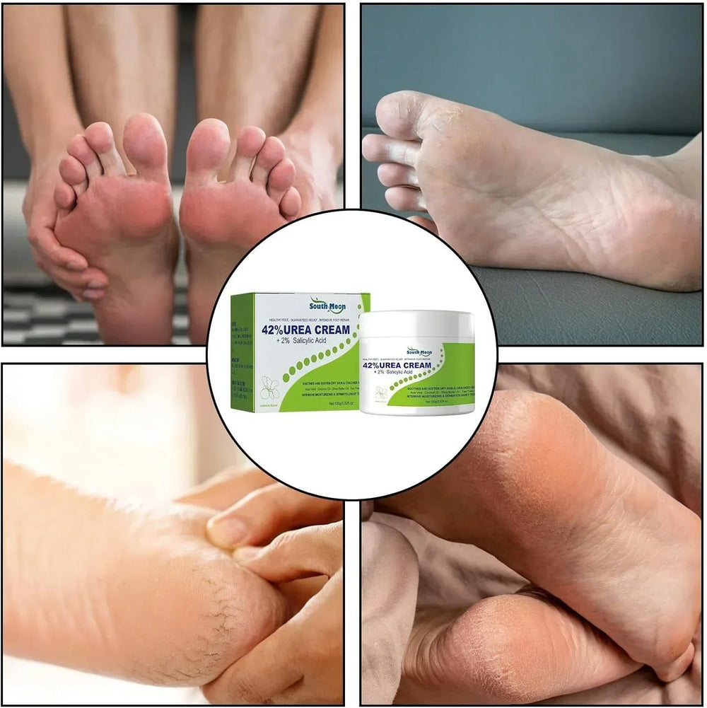 South Moon - 42% Urea Cream + 2% Salicylic Acid (Original) - Al Deyar